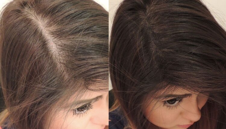 معالجة فراغات الشعر