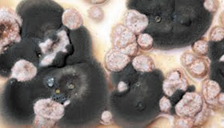 الوقاية خير من العلاج.. تعلمي كيفية تجنب الإصابة بالفطر الأسود