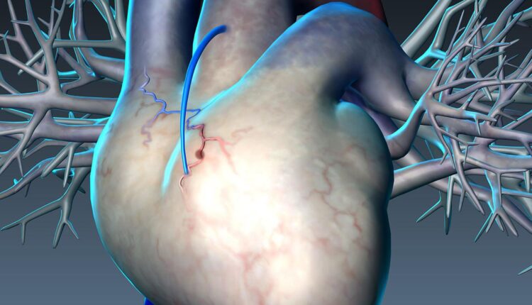 طبيب مصري بأمريكا توصل لعلاج جلطات القلب وسط أندهاش عالمي كبير