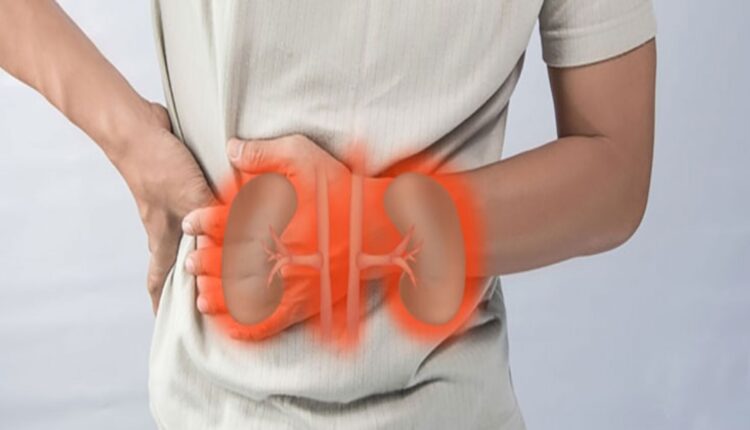 أطعمة تساعد الكلى على التخلص من السموم... تحمي من مضاعفات خطيرة