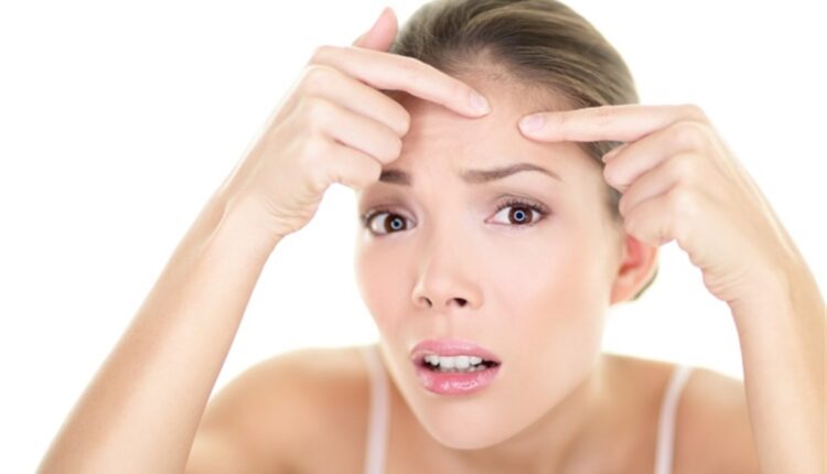 تخلصي من البثور المزعجة... التي تفاجئك في مواعيدك الهامة