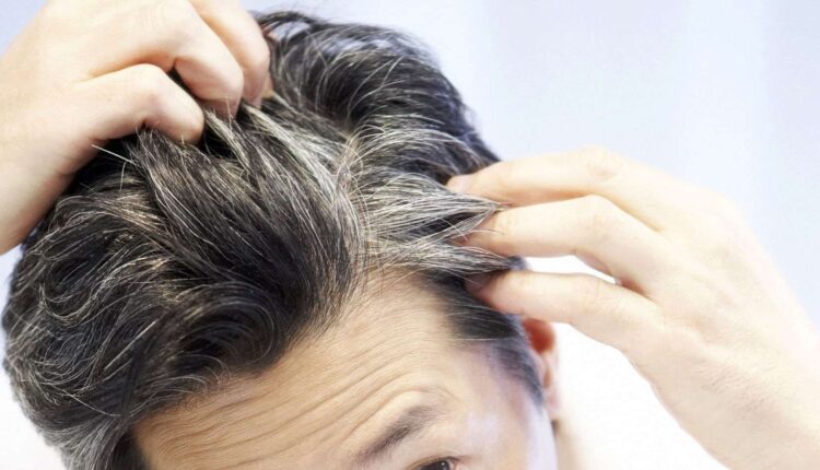 كيفية التخلص من ظهور الشعر الأبيض "الشيب" خاصة للنساء