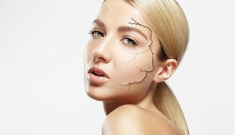 نصائح هامة لعلاج مشاكل البشرة الجافة.. لا تفوتيها