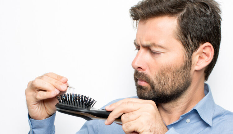 تساقط الشعر